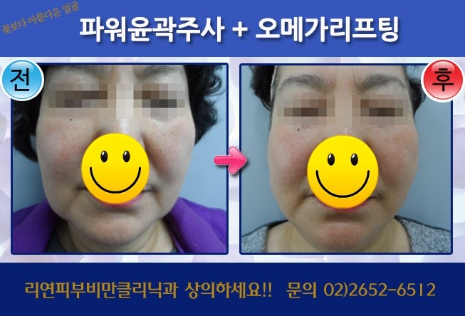 5541140022295