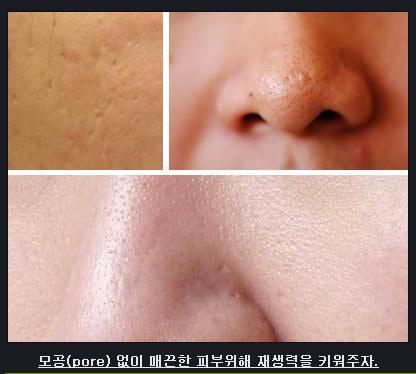 MGF_전후사진
