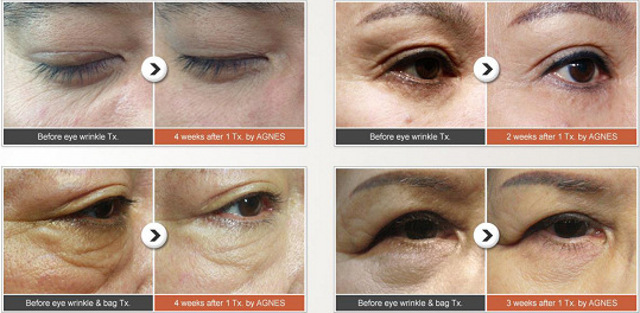 clinic_p13_content_img8